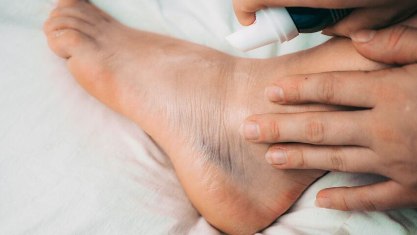 Qué significa Caí a tus pies" en español: explicación breve" 3 Qué significa Caí a tus pies» en español: explicación breve»