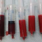 Qué color tiene la sangre realmente: mito y realidad color-sangre