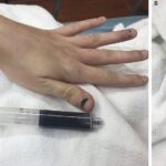 Existen personas con sangre azul: mito o realidad científica sangre-azul